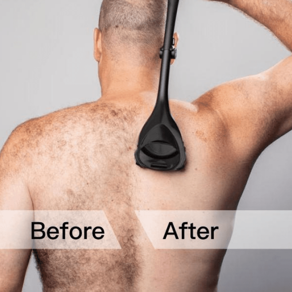 EasyReach Back Hair Shaver – Smooth Shave, No Help Needed